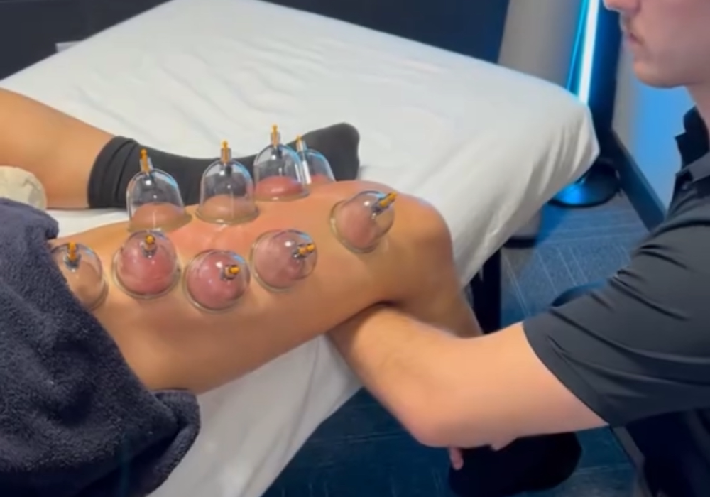 focal massage cupping