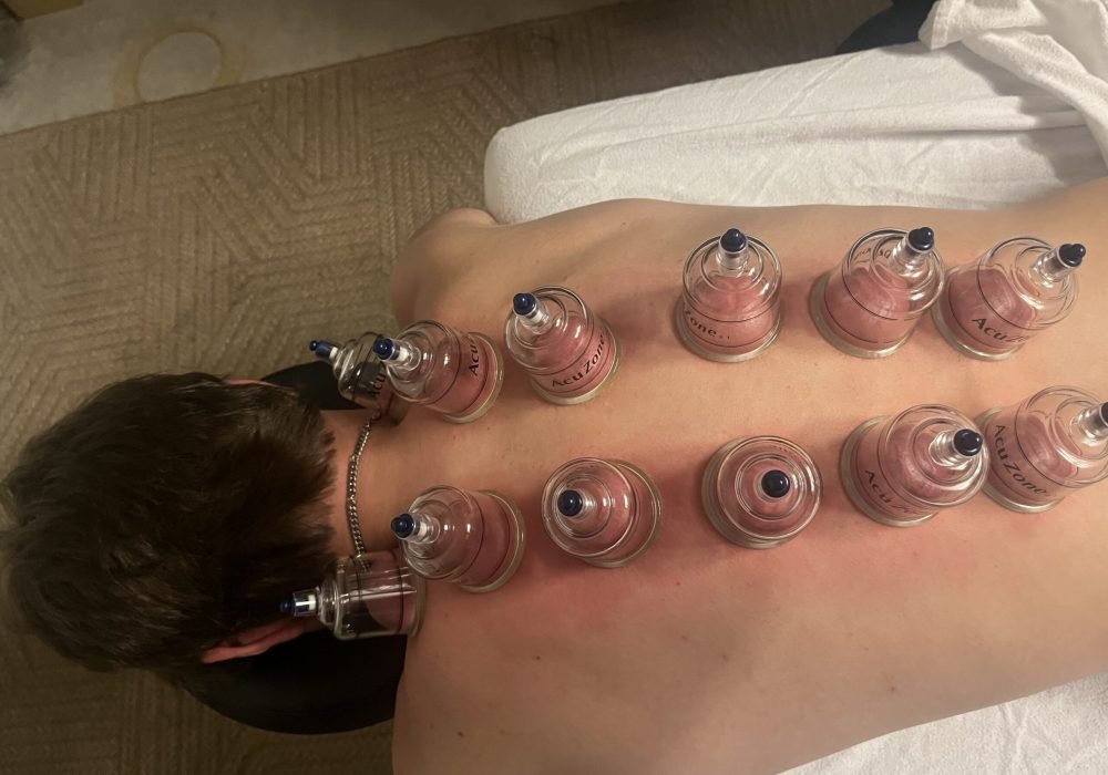 focal massage cupping
